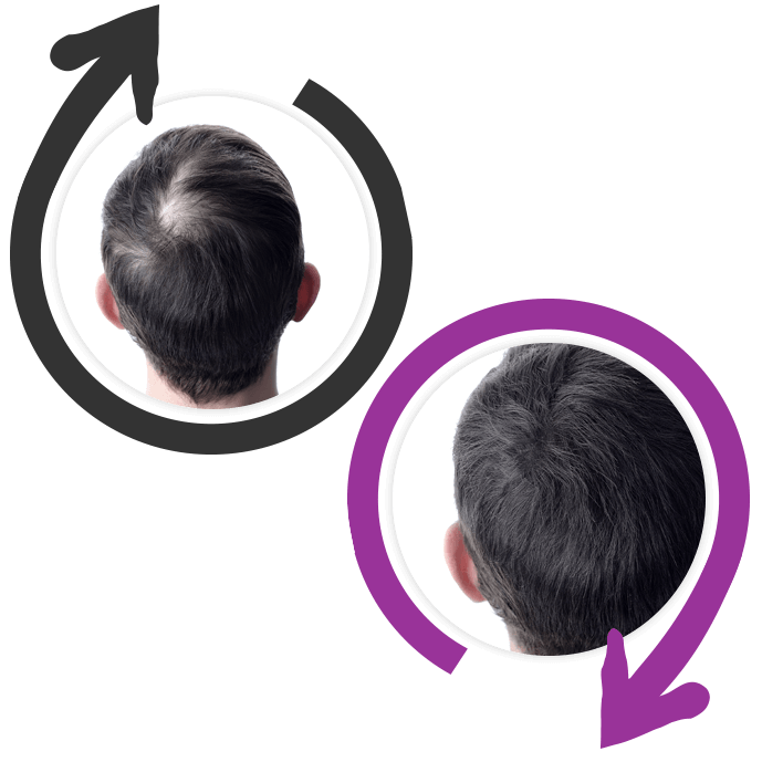 Effetti Hair Maxine lozione per ricrescita capelli naturale